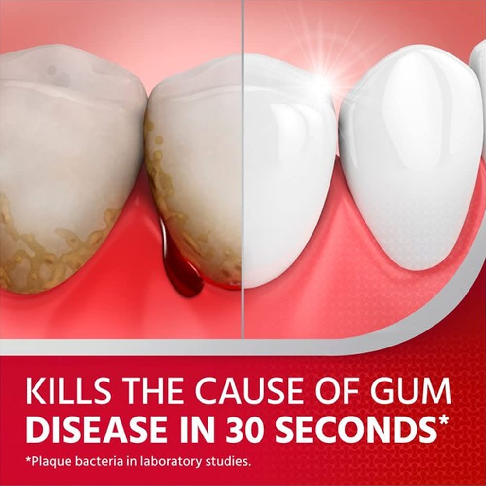 Corsodyl 0.2% Gum Disease & Bleeding Treatment Mouthwash, Alcohol Free, Mint Flavour, 300 ml - Image 3