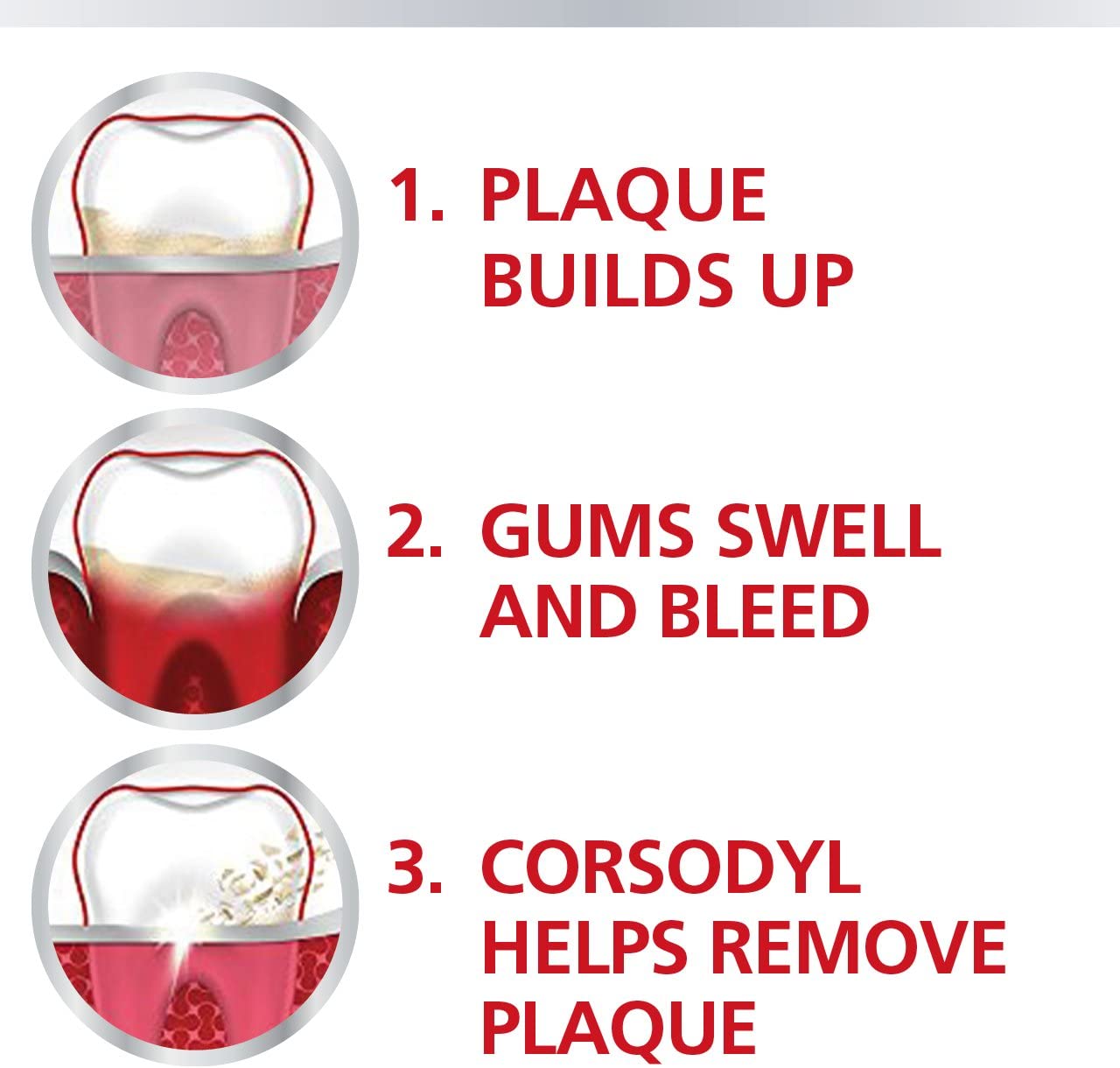 Corsodyl 0.2% Gum Disease & Bleeding Treatment Mouthwash, Alcohol Free, Mint Flavour, 300 ml - Image 4